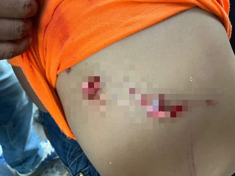 Emulo de «Chanoc»  pelea contra cocodrilo para rescatar  a su hija de las fauces del animal